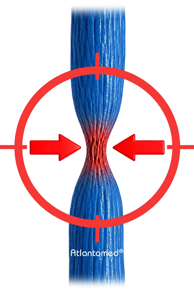 Restringimento dei vasi e l'effetto sull'apparato circolatorio